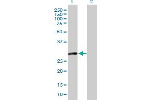 anti-MMS19 Nucleotide Excision Repair Homolog (MMS19) (AA 1-293) antibody