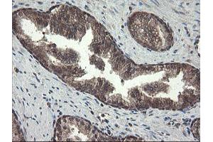PNPO antibody
