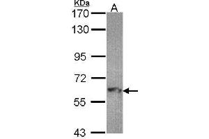 anti-Myotubularin Related Protein 9 (MTMR9) (C-Term) antibody