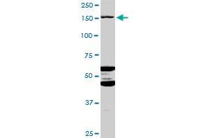 Image no. 2 for anti-ATP-Binding Cassette, Sub-Family C (CFTR/MRP), Member 11 (ABCC11) (AA 1-553) antibody (ABIN529875)