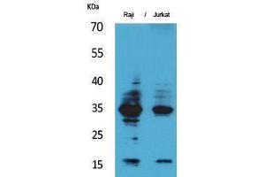 Image no. 1 for anti-Interleukin 4 (IL4) (Internal Region) antibody (ABIN3187690)