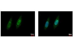 ICC/IF Image VCP antibody detects VCP protein at cytoplasm and nucleus by immunofluorescent analysis.