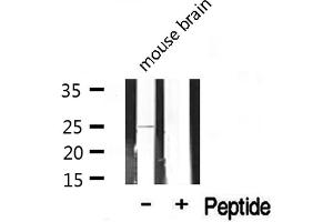 Image no. 3 for anti-Claudin 2 (CLDN2) (C-Term) antibody (ABIN6260864)