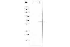 Image no. 3 for anti-Calreticulin (CALR) (N-Term) antibody (ABIN6256980)