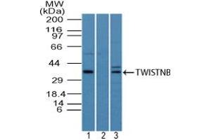 Image no. 1 for anti-TWIST Neighbor (TWISTNB) (AA 50-100) antibody (ABIN960391)