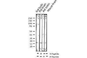 Image no. 2 for anti-Histone H3.1 (HIST1H3B) (pSer10) antibody (ABIN6254919)