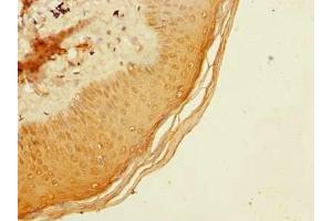 Immunohistochemistry of paraffin-embedded human skin tissue using ABIN7173532 at dilution of 1:100