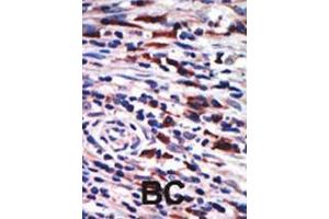 Image no. 3 for anti-Protein Kinase C, eta (PRKCH) (AA 210-239), (N-Term) antibody (ABIN391008)