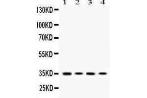 Image no. 1 for anti-Melanocortin 1 Receptor (MC1R) (AA 290-317), (C-Term) antibody (ABIN5518773)