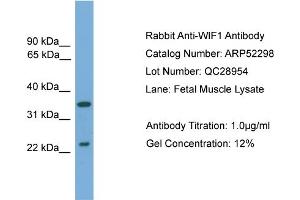 Image no. 2 for anti-WNT Inhibitory Factor 1 (WIF1) (N-Term) antibody (ABIN2784868)