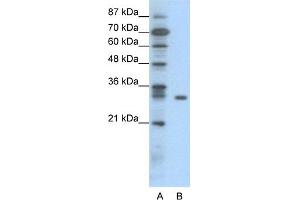 Image no. 1 for anti-NF-kappa-B inhibitor beta (NFKBIB) (N-Term) antibody (ABIN2775762)