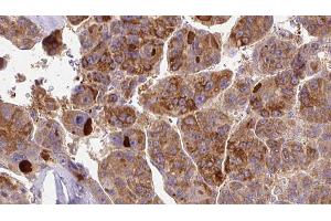 Image no. 1 for anti-Sodium Channel, Voltage-Gated, Type III, alpha Subunit (SCN3A) (Internal Region) antibody (ABIN6258331)