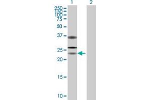 Image no. 1 for anti-Ubiquitin Specific Peptidase 53 (USP53) (AA 1-188) antibody (ABIN527105)