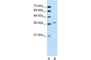 Image no. 1 for anti-Aminolevulinate Dehydratase (ALAD) (Middle Region) antibody (ABIN2776922)