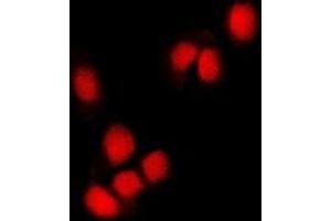 Image no. 1 for anti-Ring Finger Protein 2 (RNF2) antibody (ABIN2966988)