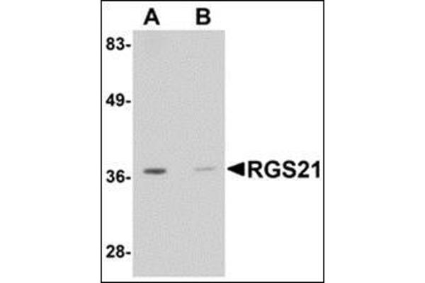 RGS21 antibody  (Center)