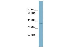 SPAG4L antibody used at 1 ug/ml to detect target protein.