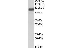 Image no. 3 for anti-Itchy E3 Ubiquitin Protein Ligase Homolog (ITCH) (Internal Region) antibody (ABIN334426)