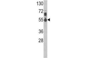 Image no. 2 for anti-Interleukin 17 Receptor B (IL17RB) (AA 207-234) antibody (ABIN3028753)