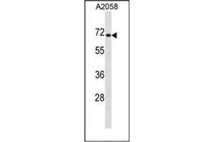 Image no. 1 for anti-Cytoplasmic Polyadenylation Element Binding Protein 1 (CPEB1) (AA 446-475), (C-Term) antibody (ABIN951677)