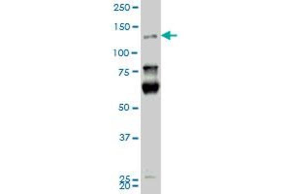 anti-Homeodomain Interacting Protein Kinase 2 (HIPK2) (AA 961-1065) antibody