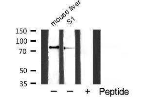 Image no. 4 for anti-conserved Helix-Loop-Helix Ubiquitous Kinase (CHUK) (pSer176), (pSer177) antibody (ABIN6256173)