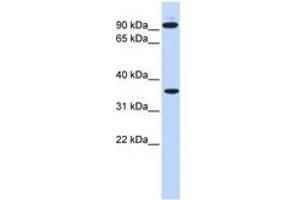 Image no. 1 for anti-Exostosin 2 (EXT2) (AA 164-213) antibody (ABIN6740864)