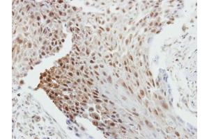 Image no. 2 for anti-B-Cell CLL/lymphoma 2 (BCL2) (N-Term) antibody (ABIN2857047)