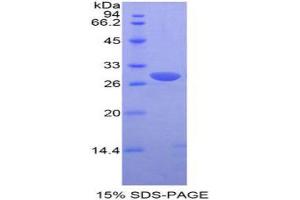 Image no. 1 for Proto-Oncogene Pim-2 (Serine Threonine Kinase) (PIM2) (AA 98-319) protein (His tag,T7 tag) (ABIN1877774)