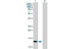 Western Blot analysis of PROK1 expression in transfected 293T cell line by PROK1 MaxPab polyclonal antibody.