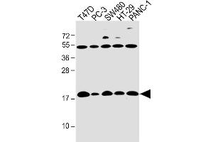 Image no. 3 for anti-Interferon Induced Transmembrane Protein 5 (IFITM5) (AA 55-83) antibody (ABIN655010)