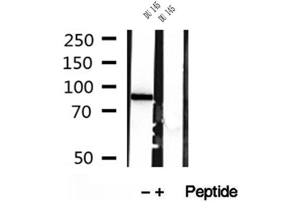 PLOD2 anticorps  (C-Term)