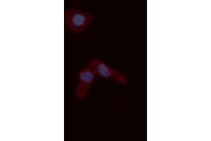Image no. 1 for anti-S100 Calcium Binding Protein A4 (S100A4) (C-Term) antibody (ABIN6264903)