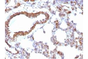 Immunohistochemistry (Formalin-fixed Paraffin-embedded Sections) (IHC (fp)) image for anti-Pan Muscle Actin antibody (ABIN3026683)