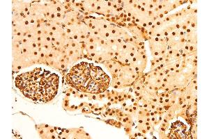 Image no. 1 for anti-Jun Proto-Oncogene (JUN) (pSer243) antibody (ABIN6255121)