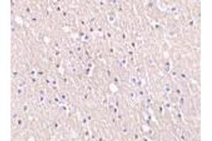 Image no. 1 for anti-Cell Death-Inducing DFFA-Like Effector A (CIDEA) (C-Term) antibody (ABIN499625)