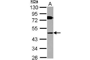Image no. 2 for anti-AChE Q Subunit (COLQ) (AA 248-455) antibody (ABIN1497560)