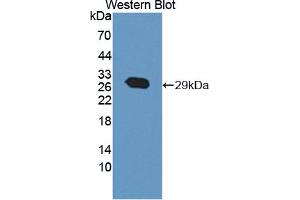 anti-ATP-Binding Cassette, Sub-Family A (ABC1), Member 12 (ABCA12) (AA 1346-1577) antibody