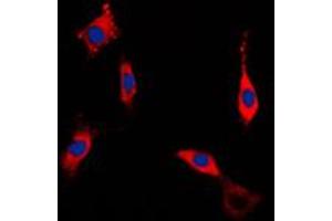 Image no. 1 for anti-rho-Associated, Coiled-Coil Containing Protein Kinase 1 (ROCK1) (Center) antibody (ABIN2706968)