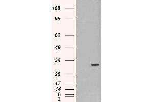 Image no. 1 for anti-Origin Recognition Complex, Subunit 6 (ORC6) (C-Term) antibody (ABIN184589)