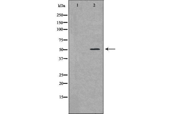 anti-BCL2-Like 13 (Apoptosis Facilitator) (BCL2L13) (Internal Region) antibody