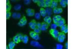 Image no. 1 for anti-Cathelicidin Antimicrobial Peptide (CAMP) antibody (ABIN350186)
