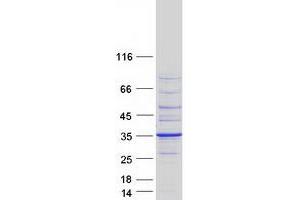 Image no. 1 for Breast Cancer Metastasis Suppressor 1 (BRMS1) (Transcript Variant 1) protein (Myc-DYKDDDDK Tag) (ABIN2715333)