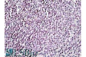 Image no. 1 for anti-Absent in Melanoma 2 (AIM2) (C-Term) antibody (ABIN571131)