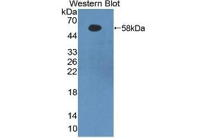 Image no. 2 for anti-Fibrinogen beta Chain (FGB) (AA 29-491) antibody (ABIN2929200)