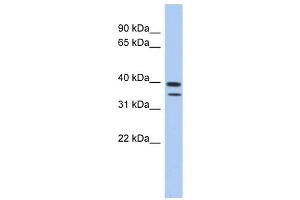 Image no. 1 for anti-Methyltransferase Like 19 (METTL19) (N-Term) antibody (ABIN632740)