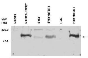 Image no. 2 for anti-Telomerase Reverse Transcriptase (TERT) (C-Term) antibody (ABIN6655270)