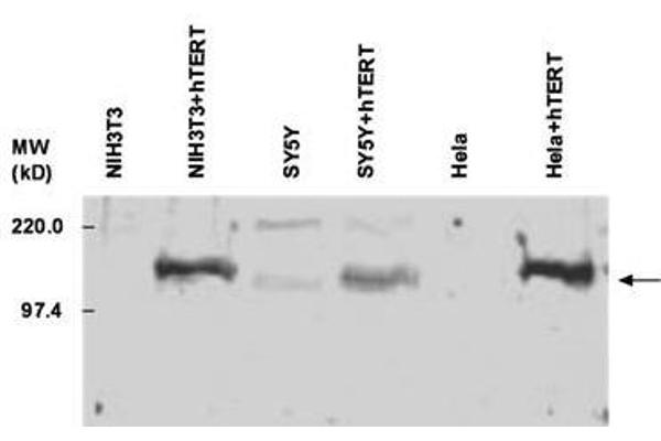 TERT Antikörper  (C-Term)