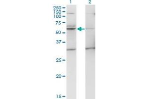 Western Blot analysis of TMPRSS5 expression in transfected 293T cell line by TMPRSS5 monoclonal antibody (M09), clone 2E5.