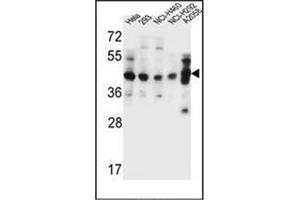 Image no. 1 for anti-General Transcription Factor IIH, Polypeptide 2C (GTF2H2C) (AA 321-351), (C-Term) antibody (ABIN952647)